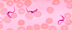Estudos Aplicados à Biologia Celular: Interação Trypanosoma cruzi-célula hospedeira