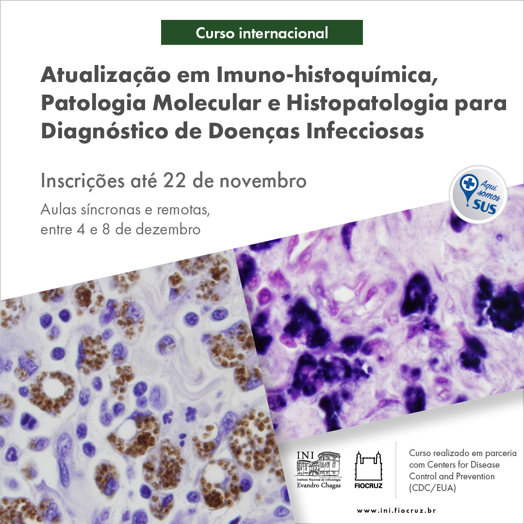 Inscrições abertas: V Curso Internacional de Atualização em Imuno-histoquímica, Patologia Molecular e Histopatologia para Diagnóstico de Doenças Infecciosas